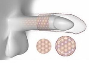 Zwiększony penis pod względem objętości